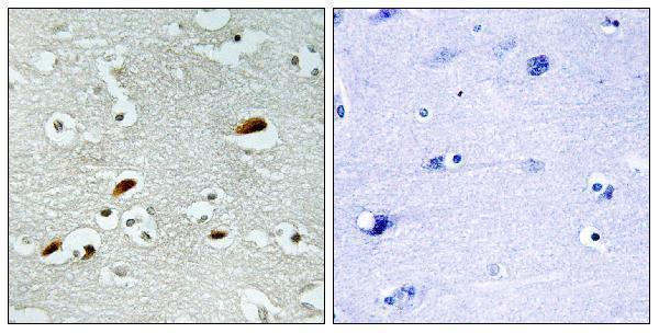 a30543 kat5 primary antibodies ihc testing 1
