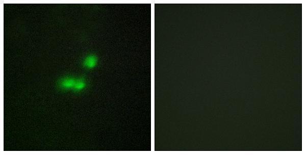 Immunofluorescence analysis of MCF7 cells, using TF3B Antibody