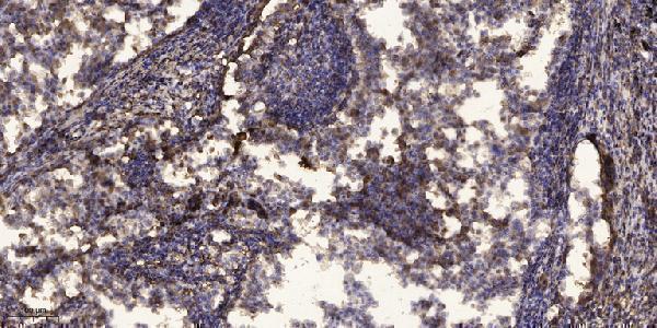 a30545 phkb primary antibodies ihc testing 1
