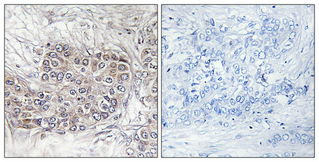 a30546 cnksr1 primary antibodies ihc testing 1