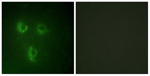 a30547 pmepa1 primary antibodies if testing 1