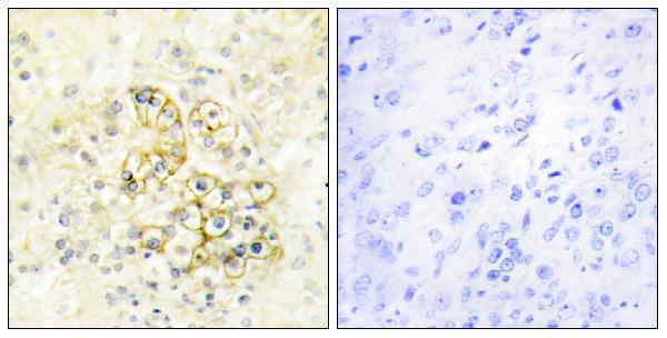 a30547 pmepa1 primary antibodies ihc testing 2