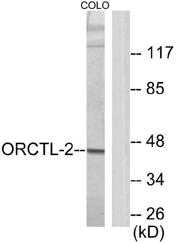 a30548 slc22a18 primary antibodies wb testing 2