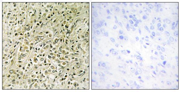 a30552 dlc1 primary antibodies ihc testing 2