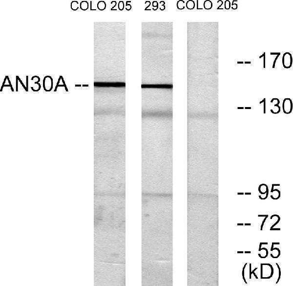 a30557 ankrd30a primary antibodies wb testing 3