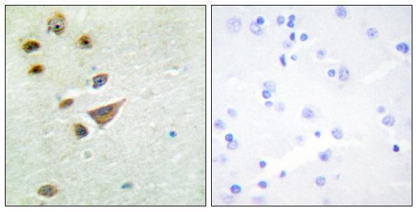 a30559 nt5c3a primary antibodies ihc testing 1