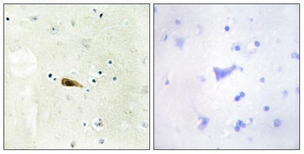 a30560 kat8 primary antibodies ihc testing 1