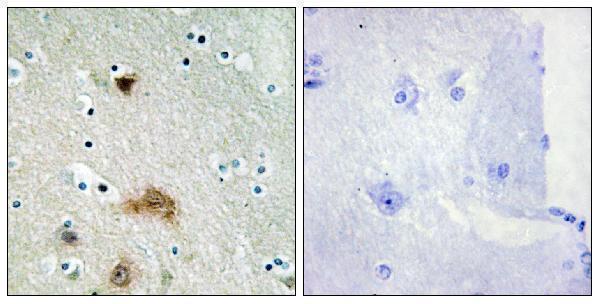 a30561 cers4 primary antibodies ihc testing 1