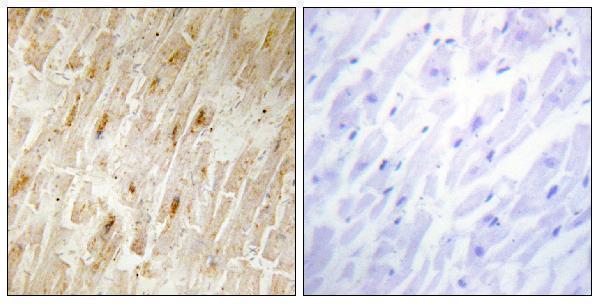 Immunohistochemistry analysis of paraffin-embedded human heart tissue, using BCA3 Antibody