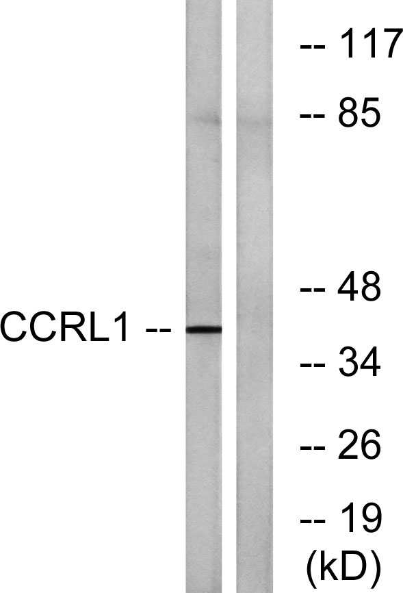 a30564 ackr4 primary antibodies wb testing 3
