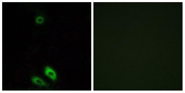 a30568 akr1c8p primary antibodies if testing 1