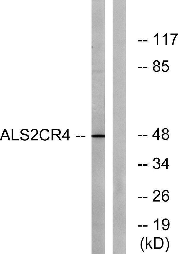 a30569 tmem237 primary antibodies wb testing 1