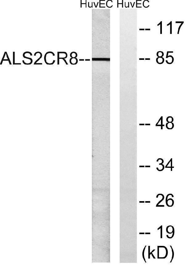 Western blot analysis of lysates from HUVEC cells, using ALS2CR8 Antibody