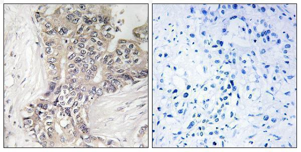 a30572 b3glct primary antibodies ihc testing 1