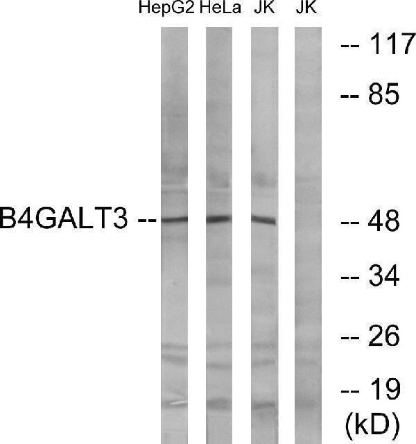 Western blot analysis of lysates from Jurkat, HeLa, and HepG2 cells, using B4GALT3 Antibody
