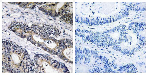 a30574 glb1l3 primary antibodies ihc testing 1