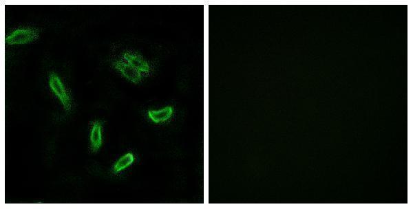 a30575 slc27a5 primary antibodies if testing 1