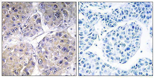a30575 slc27a5 primary antibodies ihc testing 2