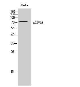 a30575 slc27a5 primary antibodies wb testing 3