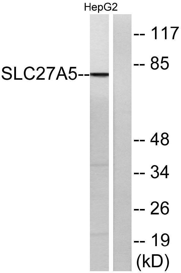 a30575 slc27a5 primary antibodies wb testing 4
