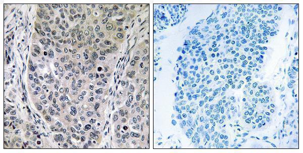 a30576 hgh1 primary antibodies ihc testing 1