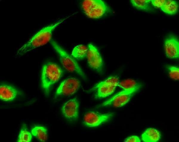 a30578 mpc1 primary antibodies if testing 1