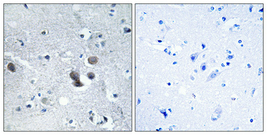 a30581 arfgef2 primary antibodies ihc testing 2