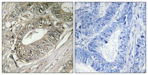 a30581 arfgef2 primary antibodies ihc testing 3