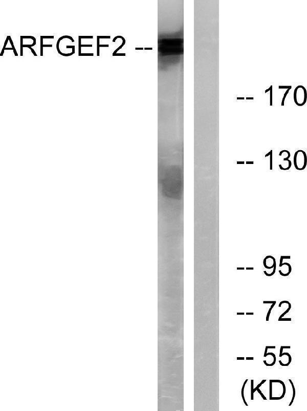 a30581 arfgef2 primary antibodies wb testing 5