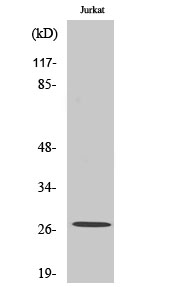 Western Blot analysis of various cells using MaxiKβ2 Polyclonal Antibody diluted at 1:500