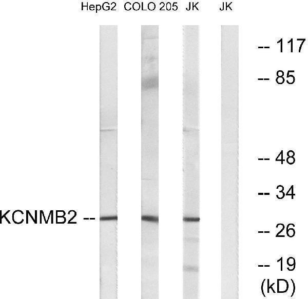 Western blot analysis of lysates from Jurkat, COLO, and HepG2 cells, using KCNMB2 Antibody