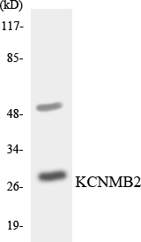 Western blot analysis of the lysates from HepG2 cells using KCNMB2 antibody