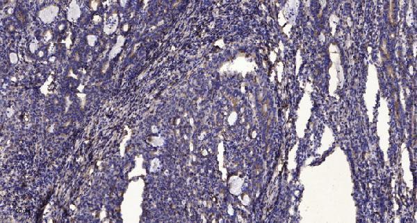 a30583 pnpla8 primary antibodies ihc testing 1