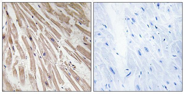 Immunohistochemistry analysis of paraffin-embedded human heart tissue, using ARPP21 Antibody