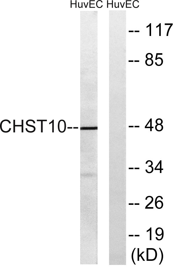 Western blot analysis of lysates from HUVEC cells, using CHST10 Antibody
