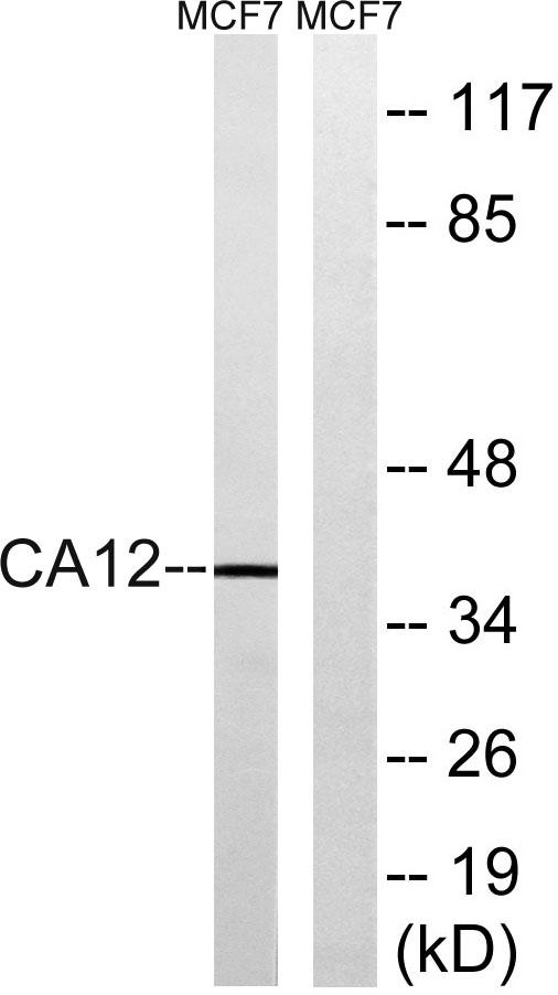 Western blot analysis of lysates from MCF-7 cells, using CA12 Antibody