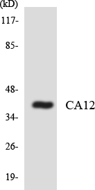 a30588 ca12 primary antibodies wb testing 4