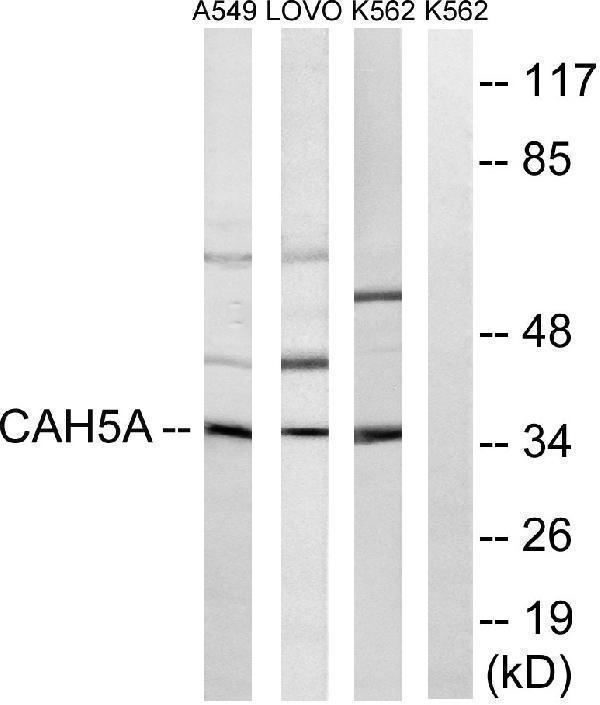 Western blot analysis of lysates from A549, LOVO, and K562 cells, using CA5A Antibody