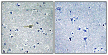 a30593 ca5b primary antibodies ihc testing 2