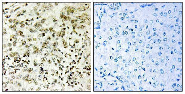 a30598 ctdsp1 primary antibodies ihc testing 1