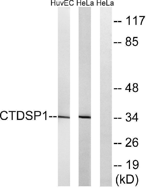 a30598 ctdsp1 primary antibodies wb testing 4
