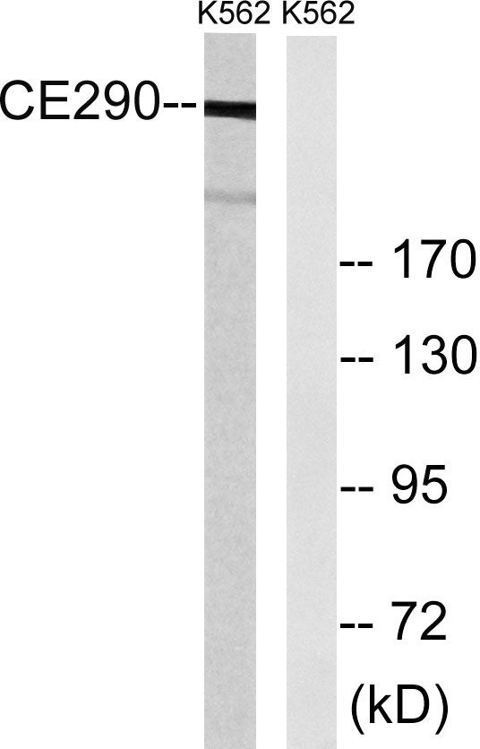 Western blot analysis of lysates from K562 cells, using CEP290 Antibody