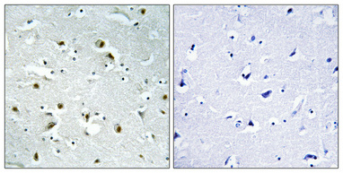 Immunohistochemical analysis of paraffin-embedded Human brain