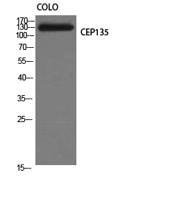 Western Blot analysis of COLO cells using CEP135 Polyclonal Antibody diluted at 1:1000