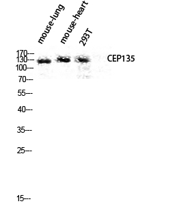 Western blot analysis of mouse-lung mouse-heart 293T lysis using CEP135 antibody