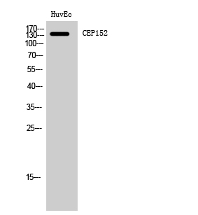 a30605 cep152 primary antibodies wb testing 2