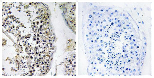 Immunohistochemistry analysis of paraffin-embedded human testis tissue, using CEP170 Antibody