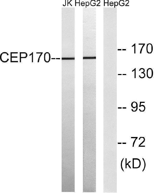 a30606 cep170 primary antibodies wb testing 4