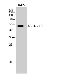 Western Blot analysis of MCF-7 cells using Cerebral 1 Polyclonal Antibody