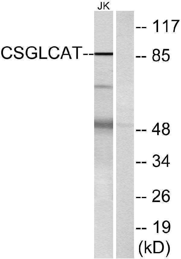 Western blot analysis of lysates from Jurkat cells, using CSGLCAT Antibody